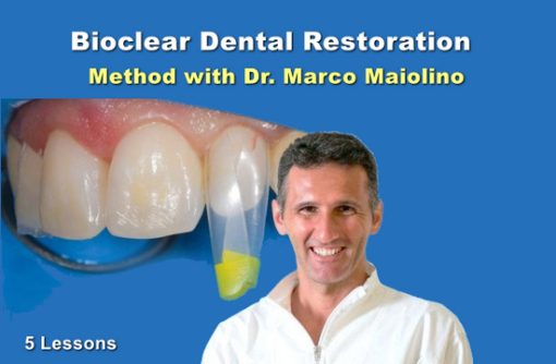 Bioclear Dental Restoration