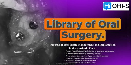 Library of Oral Surgery. Module 2: Soft Tissue Management and Implantation in the Aesthetic Zone