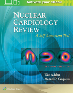 Nuclear Cardiology Review: A Self-Assessment Tool, 2nd Edition converted pdf