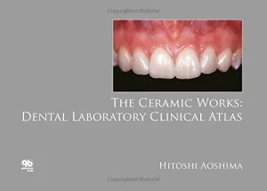 The Ceramic Works Dental Laboratory Clinical Atlas (Scanned PDF)