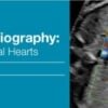 2018 Fetal Echocardiography Normal and Abnormal Hearts