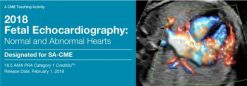 2018 Fetal Echocardiography Normal and Abnormal Hearts