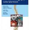 The ASSI Monographs-Lumbar Spinal Stenosis