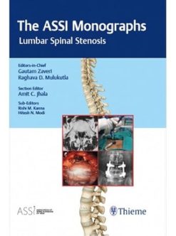 The ASSI Monographs-Lumbar Spinal Stenosis