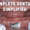 Complete Dentures Simplified