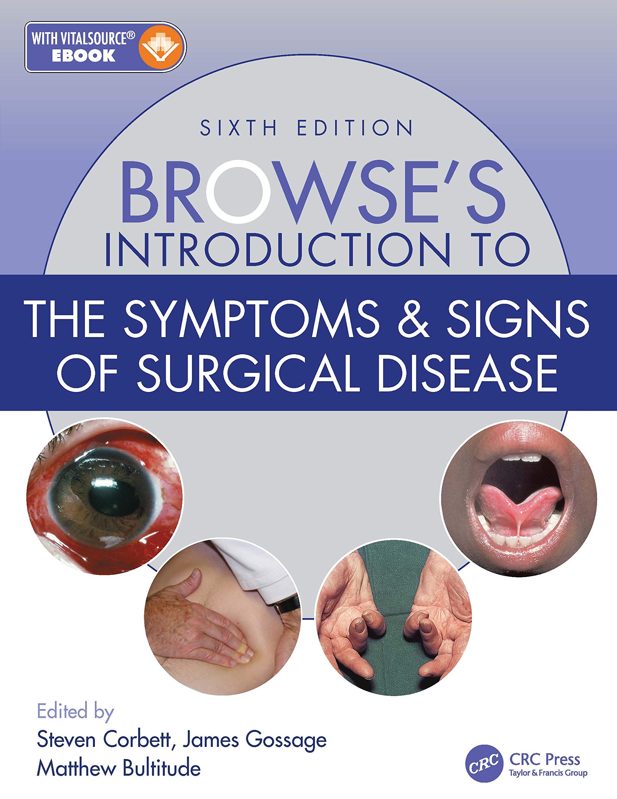 Browse’s Introduction to the Symptoms & Signs of Surgical Disease 6th Edition 81Bs7zJrluL