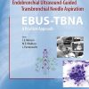 Endobronchial Ultrasound-Guided Transbronchial Needle Aspiration (EBUS-TBNA): A Practical Approach