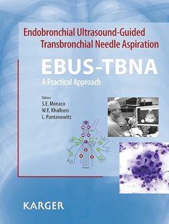 Endobronchial Ultrasound-Guided Transbronchial Needle Aspiration (EBUS-TBNA): A Practical Approach