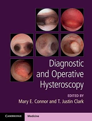 Diagnostic and Operative Hysteroscopy (Original PDF from Publisher + Videos)