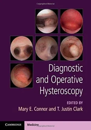 Diagnostic and Operative Hysteroscopy (ePub+Converted PDF)