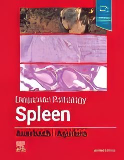 Diagnostic Pathology: Spleen, 2nd Edition (Original PDF from Publisher)