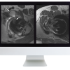ARRS Controversies In Hip And Pelvis Imaging 2016 (CME VIDEOS)