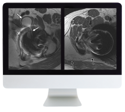 ARRS Controversies In Hip And Pelvis Imaging 2016 (CME VIDEOS)