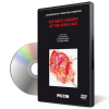 Aesthetic Surgery of the Aging Face (6 DVD BOX)