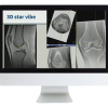 American Roentgen Ray Society 3D MR Imaging of Joints with Arthroscopy Correlations 2023