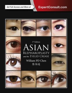 Asian Blepharoplasty and the Eyelid Crease 3rd Edition