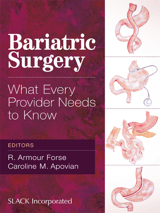 Bariatric Surgery: What Every Provider Needs To Know (EPUB) Bariatric Surgery What Every Provider Needs To Know EPUB