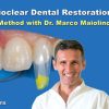 Bioclear Dental Restoration
