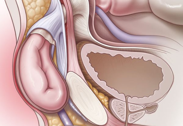 Cleveland Clinic Comprehensive Hernia Center 2019