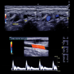 Clinical Approach to Vascular Ultrasound and RPVI Prep Course 2021