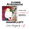 Closed Atraumatic Rhinoplasty Live Surgery DVD 1 / Digital Closed Atraumatic Rhinoplasty Live Surgery DVD 1 Digital