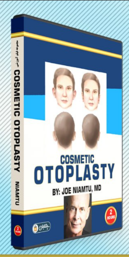 Cosmetic Otoplasty By: Dr. Joe Niamtu Cosmetic Otoplasty By: Dr. Joe Niamtu