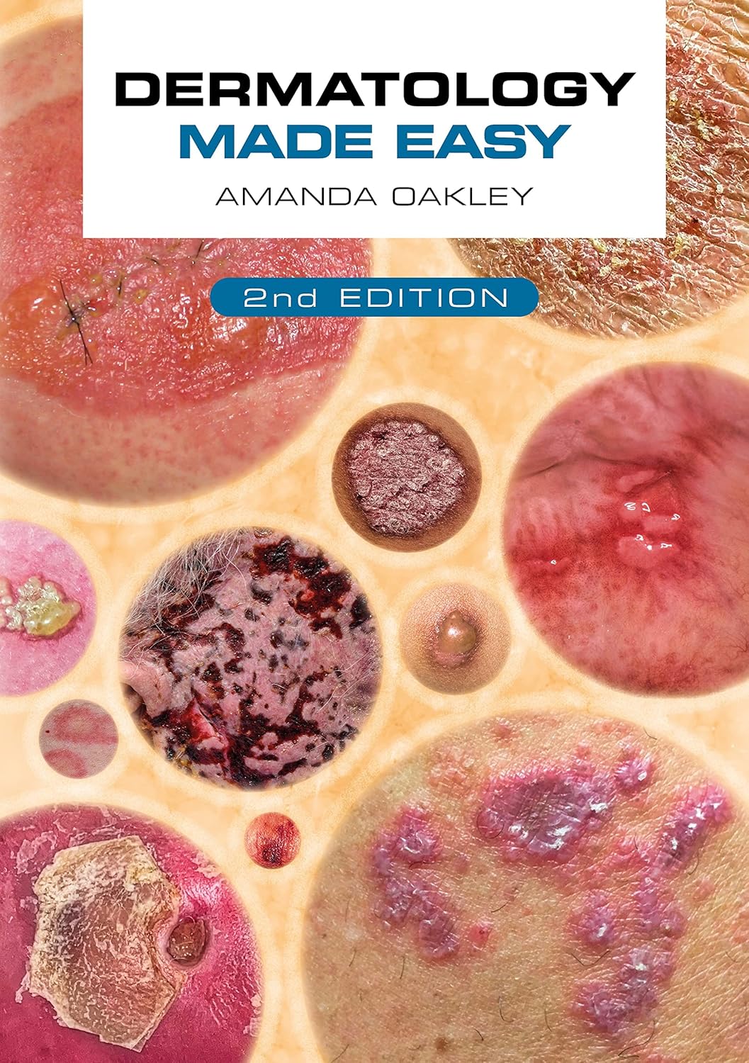 Dermatology Made Easy, second edition Dermatology Made Easy, second edition