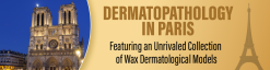 Dermatopathology in Paris Featuring an Unrivaled Collection of Wax Dermatological Models 2022