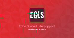 ECHO-Guided Life Support Using ultrasound to categorise shock and guide initial management (CME VIDEOS)