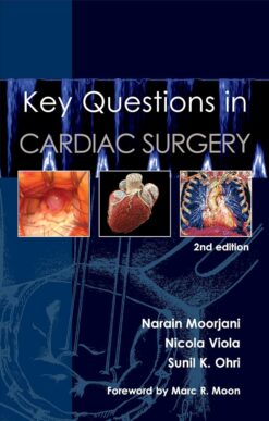 Key Questions in Cardiac Surgery (Key Questions, 4) 2nd Edition
