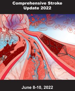 Medical College of Georgia Comprehensive Stroke Update 2022