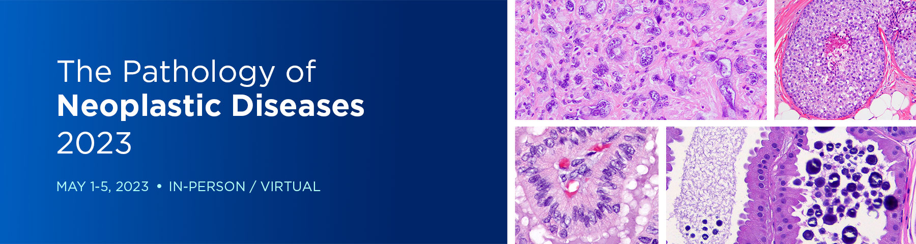 Memorial Sloan Kettering Cancer Center The Pathology of Neoplastic Diseases 2023 Memorial Sloan Kettering Cancer Center The Pathology of Neoplastic Diseases 2023