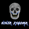Ninja Zygoma – Implant Ninja