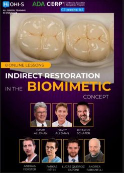 Indirect Restoration in the Biomimetic Concept