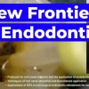 OHI-S New Frontiers in Endodontics