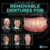 REMOVABLE DENTURES FOR DENTISTS AND TECHNICIANS