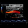Oakstone Society for Vascular Medicine Comprehensive Review of Vascular Ultrasound Interpretation and Registry Preparation 2023