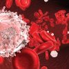 The Brigham and Dana-Farber Board Review and Comprehensive Update in Hematology and Oncology 2022 The Brigham and Dana-Farber Board Review and Comprehensive Update in Hematology and Oncology 2022