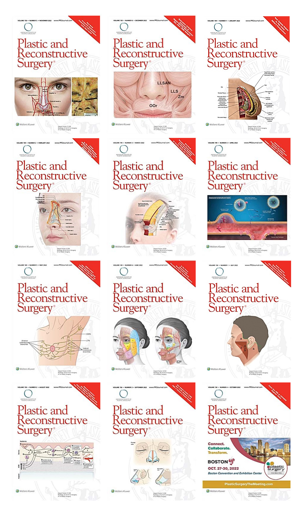 Plastic & Reconstructive Surgery 2022 Full Archives (True PDF) Plastic Reconstructive Surgery 2022 Full Archives True PDF