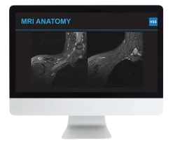 Plexus and Peripheral Nerve Imaging 2024