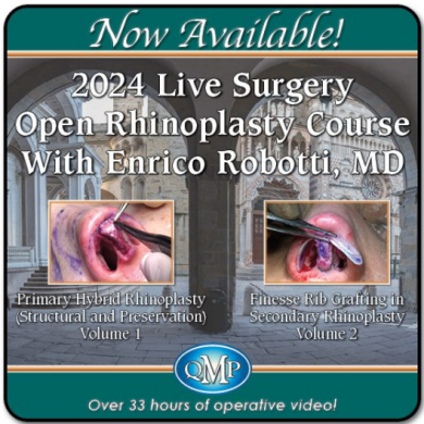 QMP 2024 Live Surgery Open Rhinoplasty Course With Enrico Robotti, MD 2-Volume Video Series Just Released! Learn Rhinoplasty From Master Surgeon Enrico Robotti! Buy Both Volumes of This Series and Save! By Enrico Robotti, MD Join Dr. Robotti in the operating room in this unique two-volume video series covering structural and preservation primary hybrid rhinoplasty and secondary rhinoplasty with finesse rib grafting techniques. Volume 1 provides viewers with a wide array of techniques, details, subtleties, and pitfalls in state-of-the-art “hybrid” primary rhinoseptoplasty, combining the very best of preservation and structural technique. All variations of cartilaginous push-down, full let-down, and modified cartilaginous push-down with enclosure of a portion of bony cap are shown. Structural management of the tip is demonstrated, with preservation–reconstruction of ligaments. Tip and dorsal dissection are shown on subperichondrial–subperiosteal planes and the use of three-point compartmentalization is demonstrated, to decrease edema and to provide proper surface contour. The new concepts of sublaminar septal dissection and interdomal ligament–septal perichondrial sling are demonstrated. The combined use of piezoelectric and power tools for osteotomies and osteoplasty is widely shown in every case. Management of the septum and turbinates is demonstrated for achieving proper function. Volume 2 demonstrates the techniques, details, subtleties, and pitfalls of using rib in four unique secondary rhinoplasty cases. This includes state-of-the-art reconstruction of the dorsum with Dr. Robotti’s innovative techniques of SPF–SPLF grafts as well as “rib cartilage plaster.” The septal T “push-up” technique, which combines elements of preservation and structure with the use of rib is also demonstrated. Secondary rhinoplasty is a complex surgery which requires dedication and a long learning curve. This video series will provide viewers with a clear algorithm, flexibility and strategy in intraoperative choices, attention to detail, and mastery of numerous tips and tricks. The use of contemporary instrumentation, combining piezoelectric and power tools, and the specific technique for rib harvesting with proper attention to the donor site, rib shaping, and laminating is extensively covered. The importance of using finely crafted rib grafts and avoiding unnecessary bulk is demonstrated in all cases. The techniques for obtaining a proper airway with proper management of the valves, as well as better aesthetics, is also extensively covered. Each case in the 2-volume set includes full preoperative discussion with proposed surgical plan and comprehensive demonstration of dissection, step-by-step surgical techniques, and final dressings. Volume 1 5 Cases With Approximately 20 Hours of Operative Video! Case 1: 46-year-old female patient with dorsal hump, drooping tip, bulbous tip, wide nasal bones, with associated chin hypoplasia. Modified dorsal split hybrid preservation: osteoplasty, full let-down, structural tip reediting with septal extension graft, ligament reconstruction, and septal fusion sling. Sublaminar septal dissection, septoplasty, piezoelectric turbinoplasty, three-point compartmentalization sutures. Chin augmentation with anatomic silicone implant inserted intraorally. Case 2: 18-year-old female patient with major dorsal hump, septal deviation, weak tip cartilages, mildly recessed chin. Modified dorsal split hybrid preservation: osteoplasty, full let-down, structural tip reediting with septal extension graft, spacer strut, alar contour grafts, ligament reconstruction, and septal fusion sling. Sublaminar septal dissection, septoplasty, piezoelectric turbinoplasty, three-point compartmentalization sutures, lipostructuring of chin. Case 3: 24-year-old male patient with wide, asymmetric nasal bones; middle vault asymmetry; septal deviation; thin skin; dorsal hump; open nasolabial angle; severe functional issues. Modified dorsal split hybrid preservation: modified cartilaginous push-down including a portion of bony cap, midvault reconstruction, osteotomies, and osteoplasty. Piezoelectric septoplasty and turbinoplasty. Structural tip reediting with auto septal extension graft, ligament sling, asymmetric turn-under/turn-over of lateral crura, spacer strut, mini alar contour grafts. Case 4: 25-year-old female patient with bulbous tip, major dorsal hump, very thin skin. Modified dorsal split hybrid preservation: osteoplasty, full let-down, structural tip reediting with septal extension graft, ligament reconstruction, and septal fusion sling. Sublaminar septal dissection, septoplasty, piezoelectric septoplasty and turbinoplasty. Deep temporalis fascia harvesting for tailored dorsal camouflage. Structural tip reediting with auto septal extension graft, ligament sling, asymmetric turn-under/turn-over of lateral crura, spacer strut, articulated grafts. Case 5: 23-year-old male patient with crooked, posttraumatic nose; bony and midvault asymmetry; septal deviation; drooping, long, asymmetric tip; excess volume; major septal deviation. Modified dorsal split hybrid preservation: cartilaginous push-down, piezoelectric septoplasty and turbinoplasty. Rib harvesting and use of rib laminations for proper L-strut septal reconstruction. Osteoplasty–osteotomies, transosseous sutures bony fixation, tip reconstruction, camouflage by “rib plaster.” Volume 2 4 Cases With Over 13 Hours of Operative Video! Case 1: Tertiary rhinoseptoplasty in 32-year-old female patient with deviation, pollybeak, inverted-V, asymmetric tip, bilateral alar retraction, functional obstruction. Burr osteoplasty, rib full L-strut reconstruction, rib extended lateral crura struts, transposition, bilateral composite grafts, SPLF graft, turbinoplasty, rib cartilage plaster. Case 2: Primary rhinoseptoplasty in 22-year-old female patient with congenital maxillary hypoplasia and saddling, bulbous tip, septal and medial crura deficiency. Burr osteoplasty and piezoelectric osteotomies, rib L-strut reconstruction by septal T push-up technique, premaxillary augmentation, SPLF graft. Case 3: Quaternary rhinoseptoplasty in 33-year-old female patient with severe tip asymmetry, pinching, external and internal valve stenosis, deviation, R alar retraction, severe functional obstruction. Burr osteoplasty, piezoelectric wedge ostectomy, full tip reconstruction, rib lateral crura struts, transposition rib full L-strut reconstruction, perichondral graft, turbinoplasty, SPLF graft. Case 4: Tertiary rhinoseptoplasty in 32-year-old male patient after previous traumas, with deviation, saddling, tip collapse, alar asymmetry, severe functional obstruction. Burr osteoplasty, piezoelectric opening osteotomies, internal valve reconstruction, rib full L-strut reconstruction, tip definition, rib lateral crura struts, transposition, SPF graft. Available in HD Streaming format. 9 cases with over 33 hours of operative video. 2024.