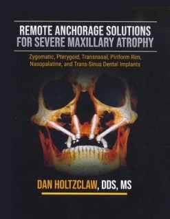 Remote Anchorage Solutions for Severe Maxillary Atrophy (Scanned Copy)