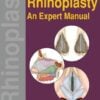 Rhinoplasty: An Expert Manual (Original PDF From Publisher)