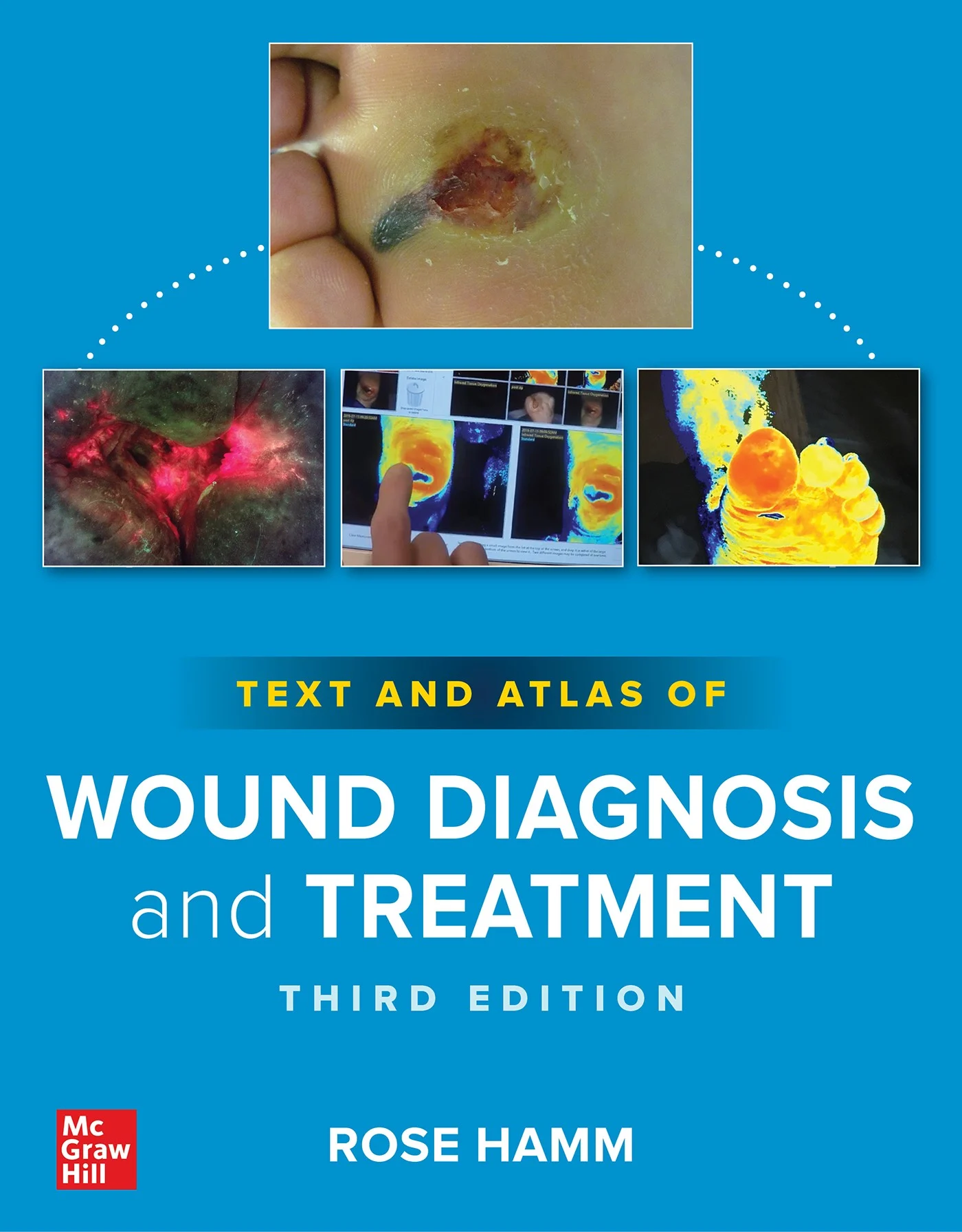 Text And Atlas Of Wound Diagnosis And Treatment, 3rd Edition (Original PDF From Publisher) Text And Atlas Of Wound Diagnosis And Treatment 3rd Edition Original PDF From Publisher