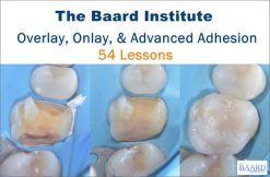 The Baard Institute Overlay, Onlay, & Advanced Adhesion