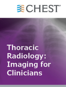 Thoracic Radiology Imaging for Clinicians (Chestnet) 2021 (Videos + Quiz)