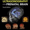 Timor’s Ultrasonography of the Prenatal Brain, 4th edition (Original PDF from Publisher)