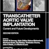 Transcatheter Aortic Valve Implantation: Current and Future Developments, 2nd edition (Original PDF from Publisher)