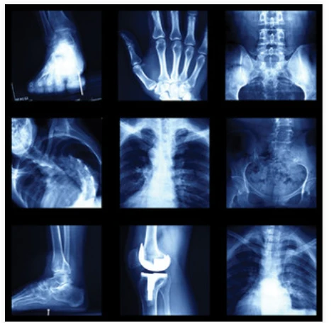 UCSF Imaging: Core and Extremities 2024 UCSF Imaging Core and Extremities 2024