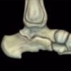 MRI Online MRI Mastery Series: Ankle 2017
